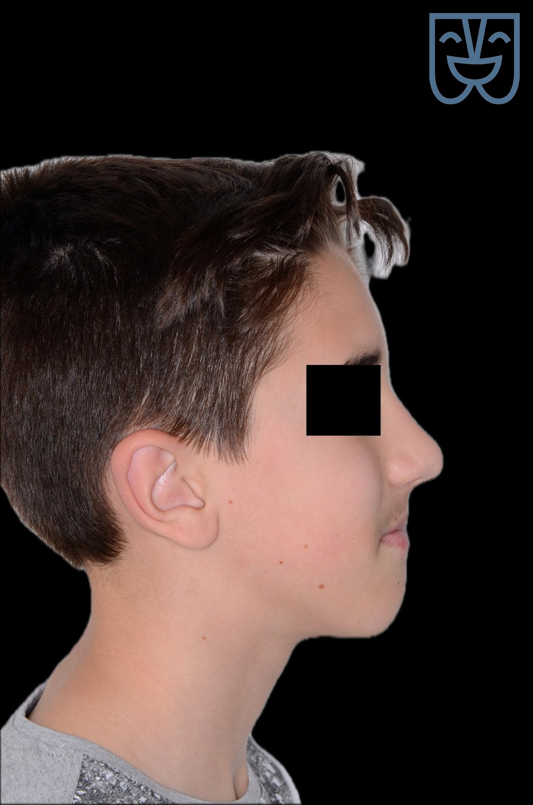 Caso 02 — profilo prima del trattamento